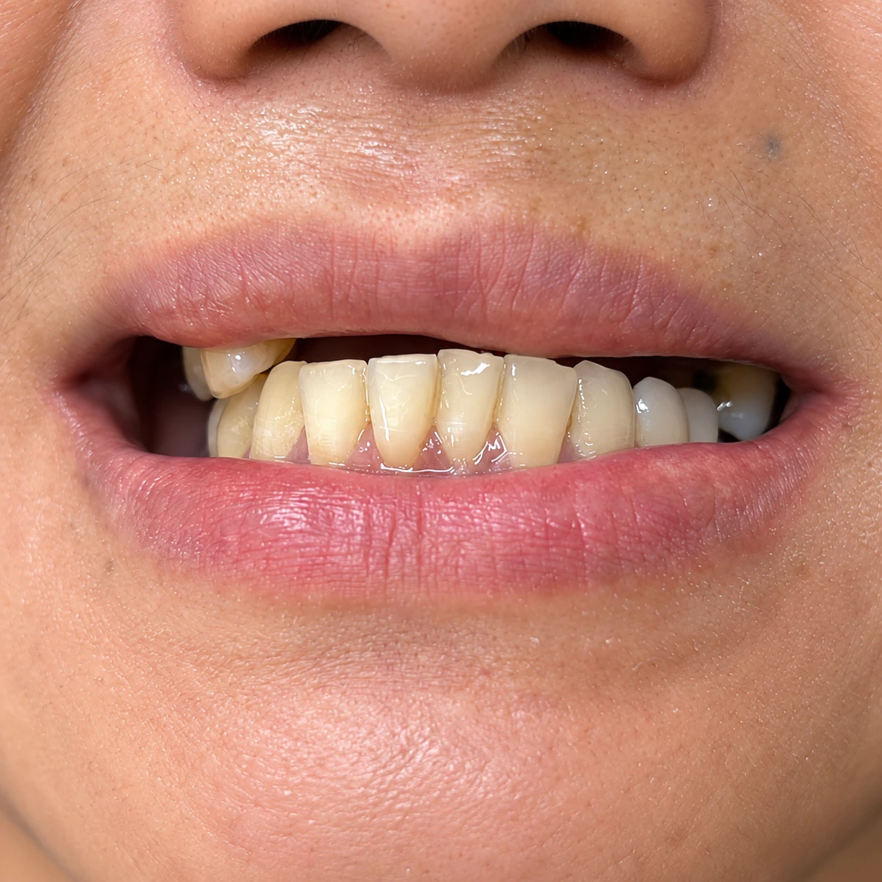 Case 01 before treatment